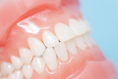 セレックシステム